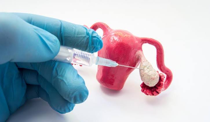 هل تنشيط المبايض يساعدني على الحمل أسرع؟ 